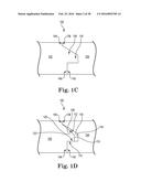 ABUTMENT JOINT diagram and image