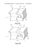 ABUTMENT JOINT diagram and image