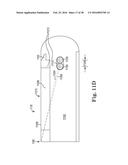 ABUTMENT JOINT diagram and image