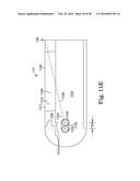 ABUTMENT JOINT diagram and image