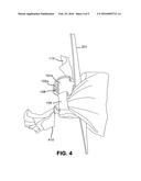 Apparatus and method for dispensing unused animal waste bag and carrying     used animal waste bag diagram and image