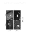 SMALL MOLECULE MEDIATED TRANSCRIPTIONAL INDUCTION OF E-CADHERIN diagram and image