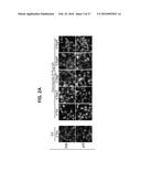 USE OF INHIBITORY PEPTIDES FOR THE TREATMENT OF INFLAMMATORY DISEASES diagram and image