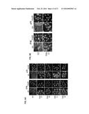 USE OF INHIBITORY PEPTIDES FOR THE TREATMENT OF INFLAMMATORY DISEASES diagram and image