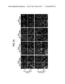 USE OF INHIBITORY PEPTIDES FOR THE TREATMENT OF INFLAMMATORY DISEASES diagram and image