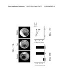 USE OF INHIBITORY PEPTIDES FOR THE TREATMENT OF INFLAMMATORY DISEASES diagram and image