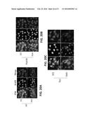 USE OF INHIBITORY PEPTIDES FOR THE TREATMENT OF INFLAMMATORY DISEASES diagram and image