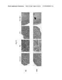 ANTIBODY SPECIFICALLY BINDING TO HER2 diagram and image