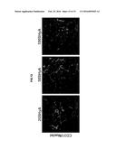 ETHYLSULFONATED HYALURONIC ACID BIOPOLYMERS AND METHODS OF USE THEREOF diagram and image