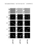 BACILLUS BASED DELIVERY SYSTEM AND METHODS OF USE diagram and image