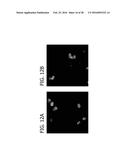 BACILLUS BASED DELIVERY SYSTEM AND METHODS OF USE diagram and image