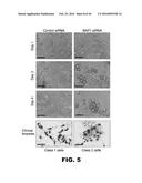 COMPOSITIONS AND METHODS FOR DETECTING CANCER METASTASIS diagram and image