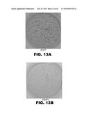 COMPOSITIONS AND METHODS FOR DETECTING CANCER METASTASIS diagram and image