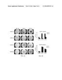 GENETIC AMPLIFICATION OF IQGAP1 IN CANCER diagram and image