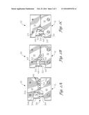 Interlocking Clip System diagram and image