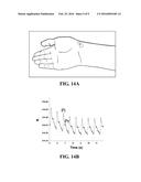 CORE-SHELL NANOFIBER TEXTILES FOR STRAIN SENSING, AND METHODS OF THEIR     MANUFACTURE diagram and image