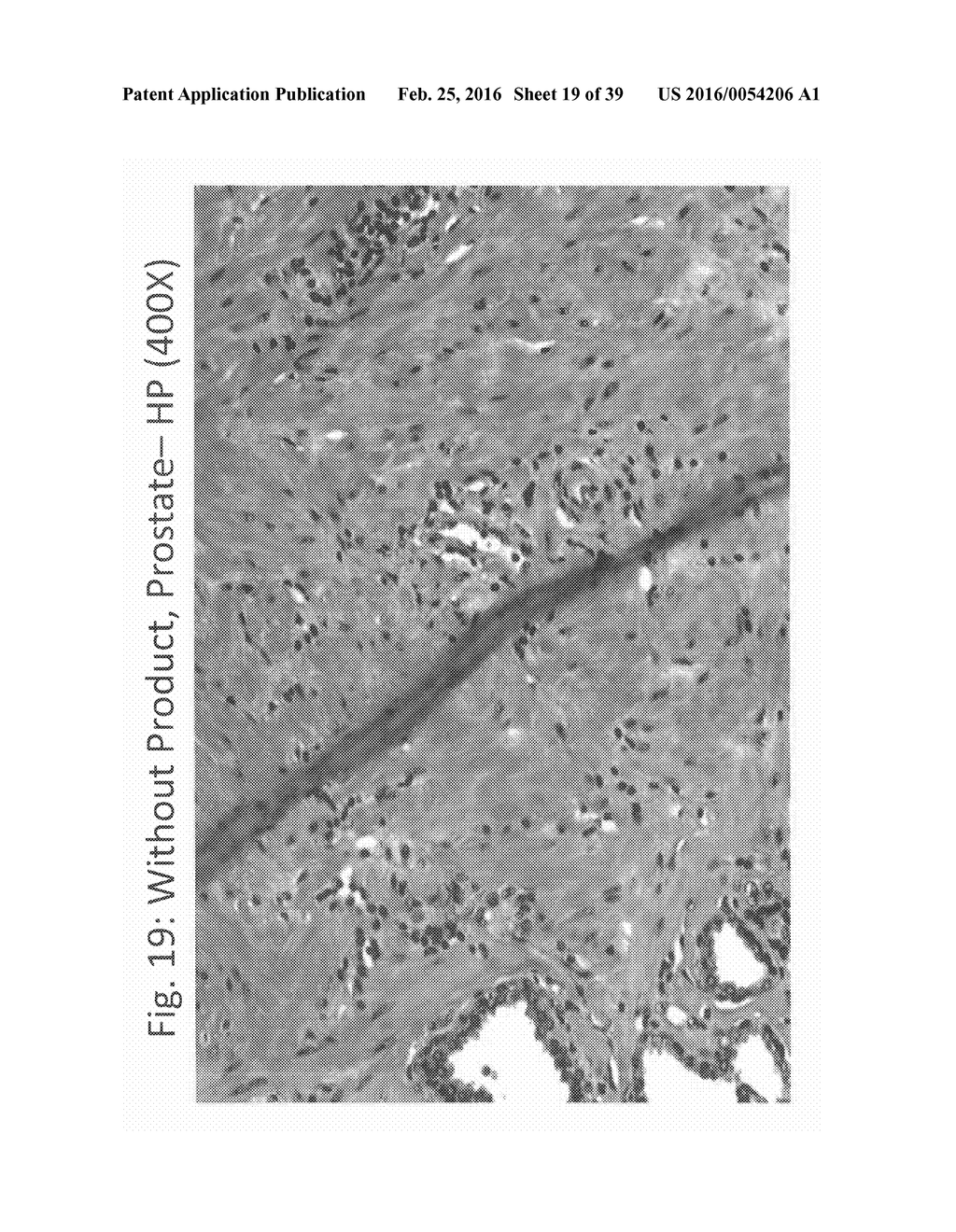 AQUEOUS COMPOSITIONS AND METHODS OF USING THE SAME FORHISTOPATHOLOGICAL     EVALUATION OF TISSUE SAMPLES - diagram, schematic, and image 20