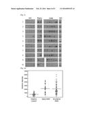 MARKER FOR DIAGNOSING AGE-RELATED MACULAR DEGENERATION, AND METHOD FOR     DIAGNOSING AGE-RELATED MACULAR DEGENERATION BY USING SAME diagram and image