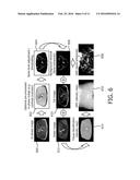 DETECTION OF BONE TISSUE USING MAGNETIC RESONANCE IMAGING diagram and image