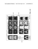 DETECTION OF BONE TISSUE USING MAGNETIC RESONANCE IMAGING diagram and image