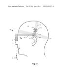 HEADSET HAVING VERSATILE EYE ORIENTATION ADJUSTMENT SYSTEM diagram and image