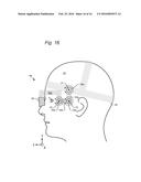 HEADSET HAVING VERSATILE EYE ORIENTATION ADJUSTMENT SYSTEM diagram and image