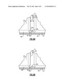 TWIST-LOCK BATTERY PACK ATTACHMENT DEVICE diagram and image