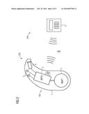 METHOD, DEVICE, AND SYSTEM FOR SUPPRESSING FEEDBACK IN HEARING AID DEVICES     WITH ADAPTIVE SPLIT-BAND FREQUENCY diagram and image