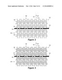 KNITTED COMPONENT HAVING TENSILE STRAND FOR ADJUSTING AUXETIC PORTION diagram and image