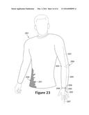 KNITTED COMPONENT HAVING TENSILE STRAND FOR ADJUSTING AUXETIC PORTION diagram and image