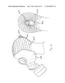 DEVICES AND METHODS FOR ENHANCING THE FIT OF BOOTS AND OTHER FOOTWEAR diagram and image