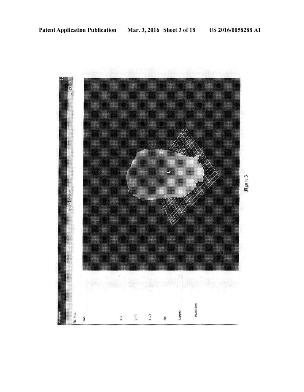 THREE DIMENSIONAL TISSUE IMAGING SYSTEM AND METHOD - diagram, schematic, and image 04