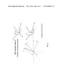 SYSTEM AND MEHTOD FOR BIVENTRICULAR PACEMAKER PULSE DETECTION IN SURFACE     ECG diagram and image