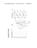 SYSTEM AND MEHTOD FOR BIVENTRICULAR PACEMAKER PULSE DETECTION IN SURFACE     ECG diagram and image