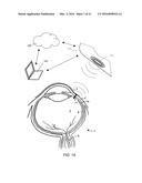 ULTRA LOW POWER CHARGING IMPLANT SENSORS WITH WIRELESS INTERFACE FOR     PATIENT MONITORING diagram and image