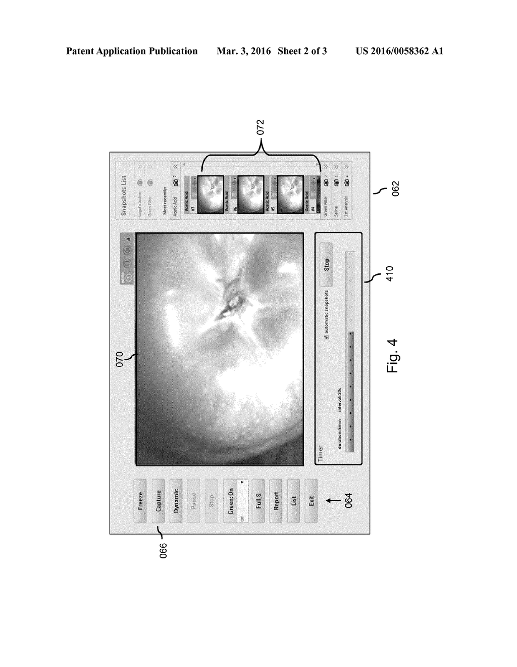 ACQUIRING CERVICAL IMAGES - diagram, schematic, and image 03