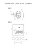 ULTRASONIC URINE VOLUME MEASURING INSTRUMENT, URINE VOLUME MANAGEMENT DATA     GENERATING METHOD USING ULTRASONIC URINE VOLUME MEASURING INSTRUMENT, AND     BLADDER TRAINING METHOD USING ULTRASONIC URINE VOLUME MEASURING     INSTRUMENT diagram and image