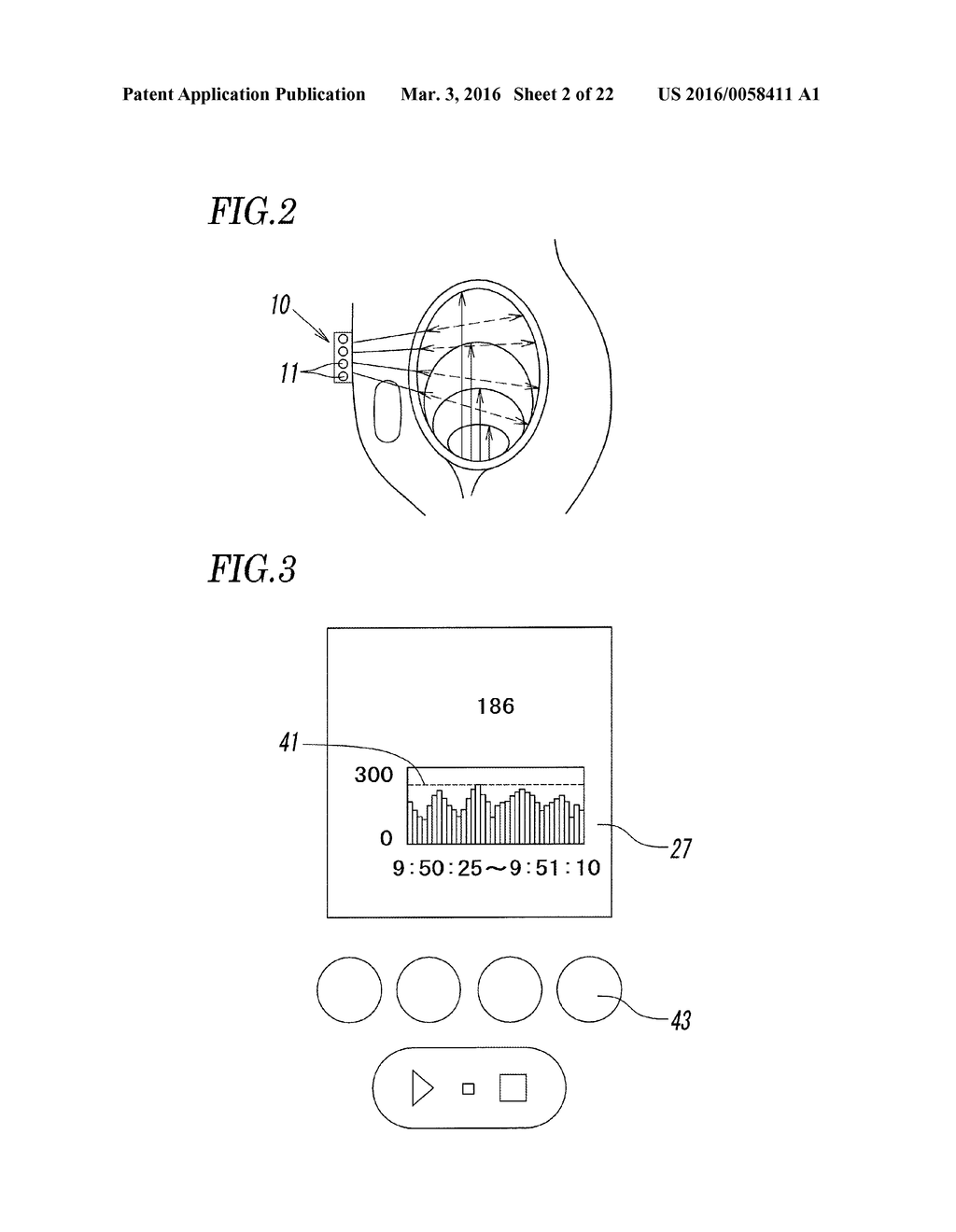 ULTRASONIC URINE VOLUME MEASURING INSTRUMENT, URINE VOLUME MANAGEMENT DATA     GENERATING METHOD USING ULTRASONIC URINE VOLUME MEASURING INSTRUMENT, AND     BLADDER TRAINING METHOD USING ULTRASONIC URINE VOLUME MEASURING     INSTRUMENT - diagram, schematic, and image 03