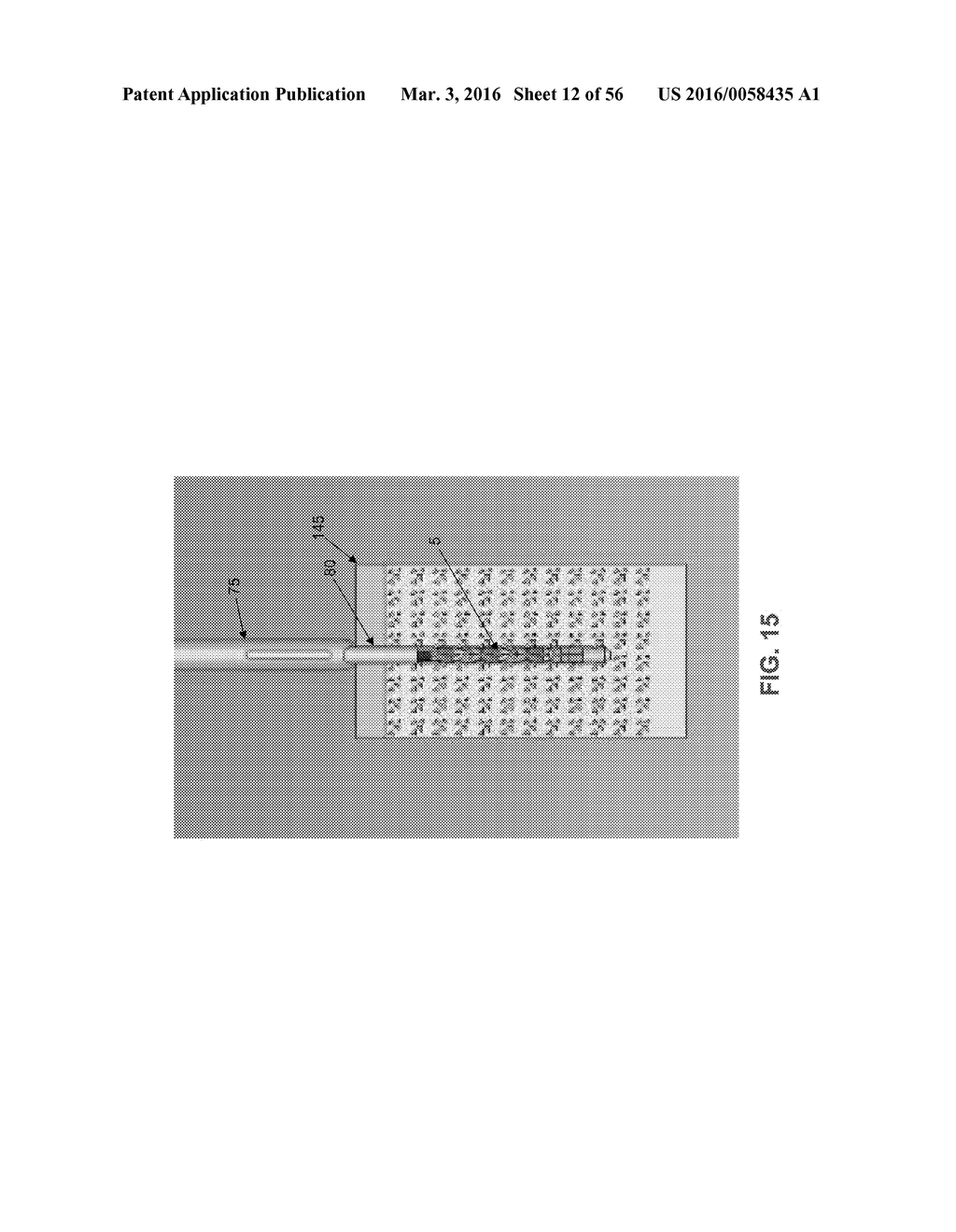 METHOD AND APPARATUS FOR SECURING AN OBJECT TO BONE, INCLUDING THE     PROVISION AND USE OF A NOVEL SUTURE ASSEMBLY FOR SECURING AN OBJECT TO     BONE - diagram, schematic, and image 13