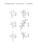 Devices and Methods for Stabilizing Fasteners Post-Deployment diagram and image