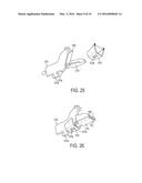 Devices and Methods for Stabilizing Fasteners Post-Deployment diagram and image