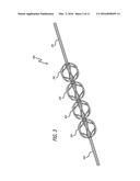 Obstruction Removal System diagram and image