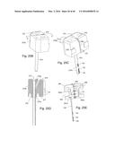 Subcutaneous sensor inserter and method diagram and image