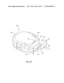 Subcutaneous sensor inserter and method diagram and image