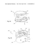 Subcutaneous sensor inserter and method diagram and image