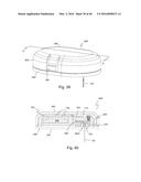 Subcutaneous sensor inserter and method diagram and image