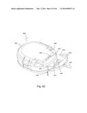 Subcutaneous sensor inserter and method diagram and image