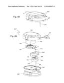 Subcutaneous sensor inserter and method diagram and image