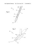 Subcutaneous sensor inserter and method diagram and image