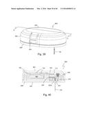 Subcutaneous sensor inserter and method diagram and image